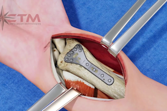make realistic 3d medical animation video 3d medical product animation video
