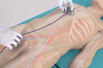 offer 3d medical animation 3d surgery process animation 3d medical anatomy model