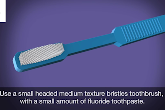 do 3d medical animation video, 3d medical dental animation, surgery animation