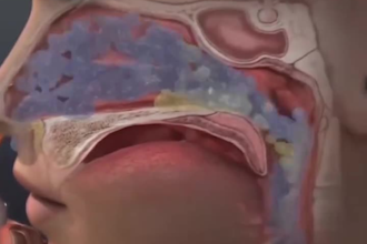 3d medical animation, 3d medical explainer video, 3d character animation