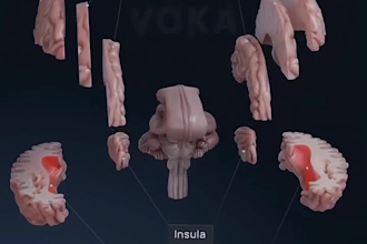 create 3d surgical explainer video, 3d medical animation, 3d cgi medical device