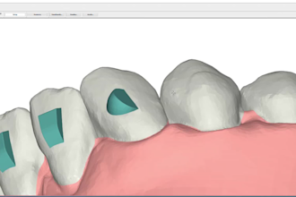 treatment planning service for clear aligners
