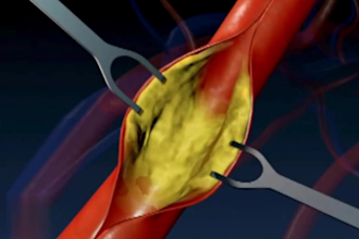 3d vfx medical animation dental animation 3d explainer video surgery animation