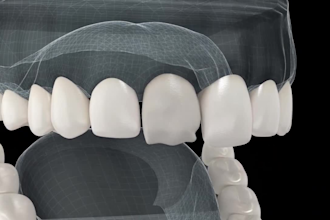 3d medical animation 3d dental teeth organ animation 3d medical explainer video