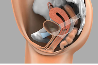 3d surgery animation 3d medical video 3d anatomy skull dental medical explainer