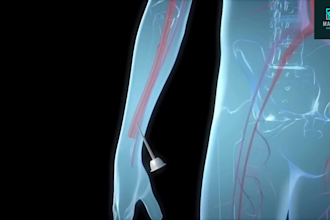 do 3d medical animation, 3d medical device procedure, 3d medical explainer video