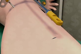 create realistic 3d medical animation and surgery visuals
