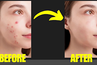 remove birthmarks, wrinkles, improve, beauty retouching