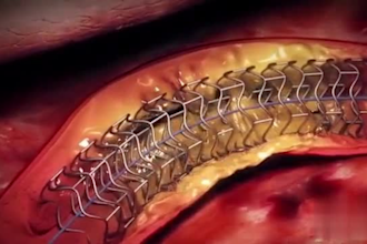 do 3d medical animation 3d scientific animation and 3d surgery animation
