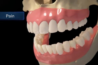 2d 3d medical animation anatomy scientific biomedical animation explainer video