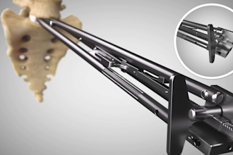 3d medical animation, medical animation, medical device, surgery animation