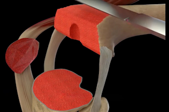 create 2d 3d medical animation explainer video medical illustration and anatomy