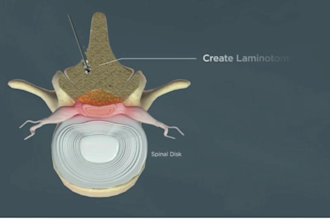 do 3d medical explainer 3d medical animation surgery animation medical animation
