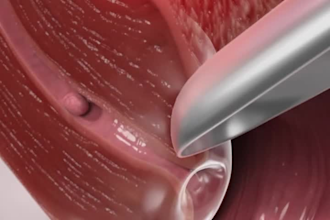 do medical animation, surgery animation, anatomy animation, 3d medical animation