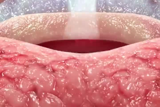 do 3d animation,medical animation,medical 3d medical animation surgery animation