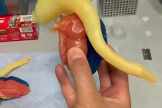 create a 3d model from ct or mri scans
