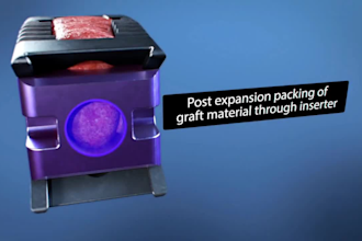 3d medical animation for orthopedic procedures surgical education patient video