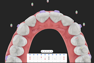provide dental clear aligners treatment planning services