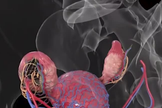 build hyper realistic 3d anatomy video medical illustration  3d medical surgery