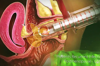 do 3d medical animation, 3d explainer video, 3d medical video, surgery animation