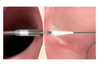 do 3d medical animation transcatheter cardiology heart failure explainer video