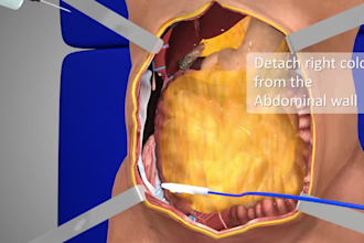 do medical 3d product animation, cad modeling, cgi render and device explainer