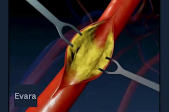 2d 3d medical animation anatomy 3d medical product 3d medical animation