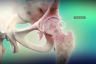 do 3d medical animation, surgery video, human anatomy, and anatomical explainer
