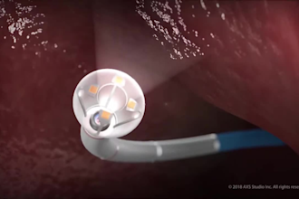 create high end medical 3d medical animation for product or procedure