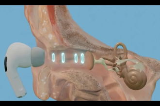 edit and animate medical and surgical videos