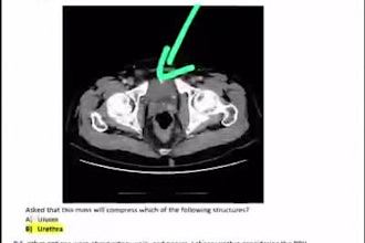 usmle recalls for step 1,2ck and step 3