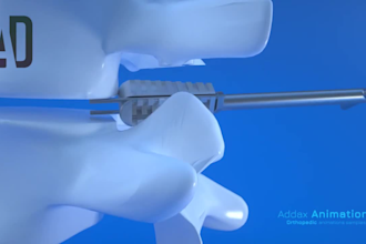 create stunning orthopedic  3d animations and renderings