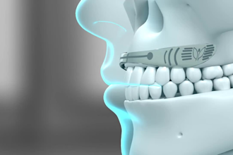 3d medical anatomy, medical animation, medical surgery video