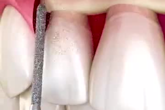 create 3d medical animation for surgery, anatomy, or pharma