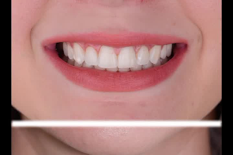 dental photographer on photoshop
