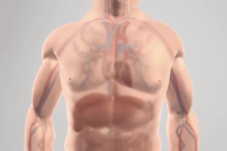 3d medical product animation, medical device animation, 3d medical animation