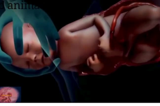 do 3d medical animation, 3d surgical animation, 3d medical explainer video