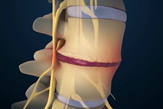 do 3d spine animation 3d surgery animation orthopedic biotech medical video