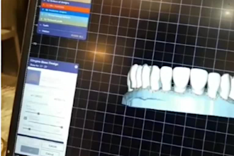 design dental constructions for you using exocad