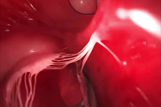 do dynamic 3d medical animation 3d anatomy animation 3d surgery animation