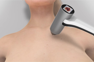 create 3d medical device animation, 3d medical animation, 3d surgery video