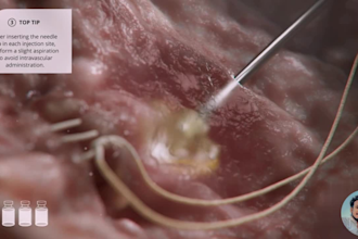 deliver high quality 3d medical animations