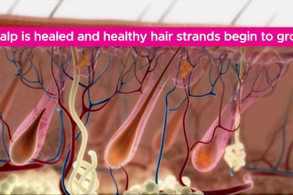 make realistic 3d medical animation, 3d surgery animation, 3d medical anatomy