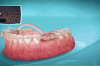 3d medical animation dental animation medical explainer video anatomy modelling