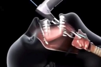 create stunning 3d medical animation for healthcare and science