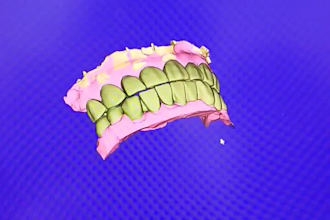 design all kind of dental prosthesis using exocad