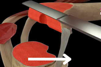 make 3d medical animation video to explain a medical process