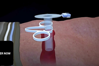 do 3d medical animation for 3d ostomy device, dental surgery, 3d teeth animation