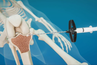 do high quality 3d medical animation, surgical and medical 3d product model