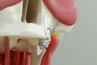 make 3d animation for dental implant or surgical procedure